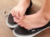 Грибок между пальцами ног: симптомы, виды, эффективные методы лечения Межпальцевые микозы ногах лечение